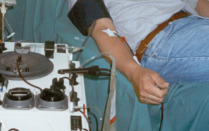 Trasfusione-plasma iperimmune-sangue