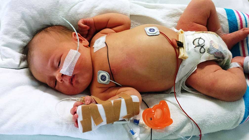 Registro tumori infantili e dell’adolescenza: subito una rete oncologica regionale 1 Bambino
