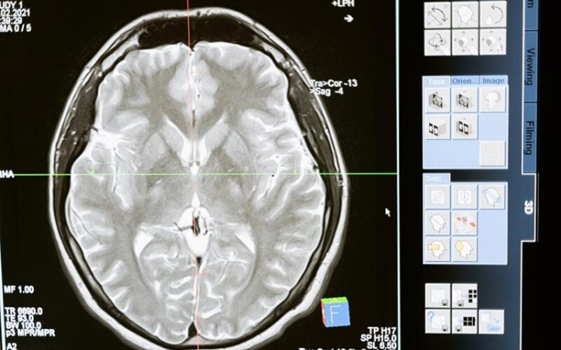 Esame radiografico epilessia