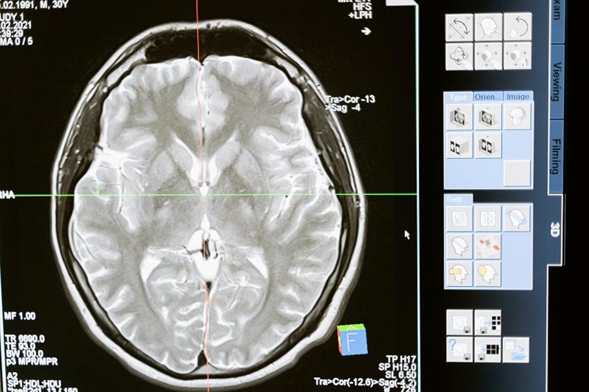 Esame radiografico epilessia