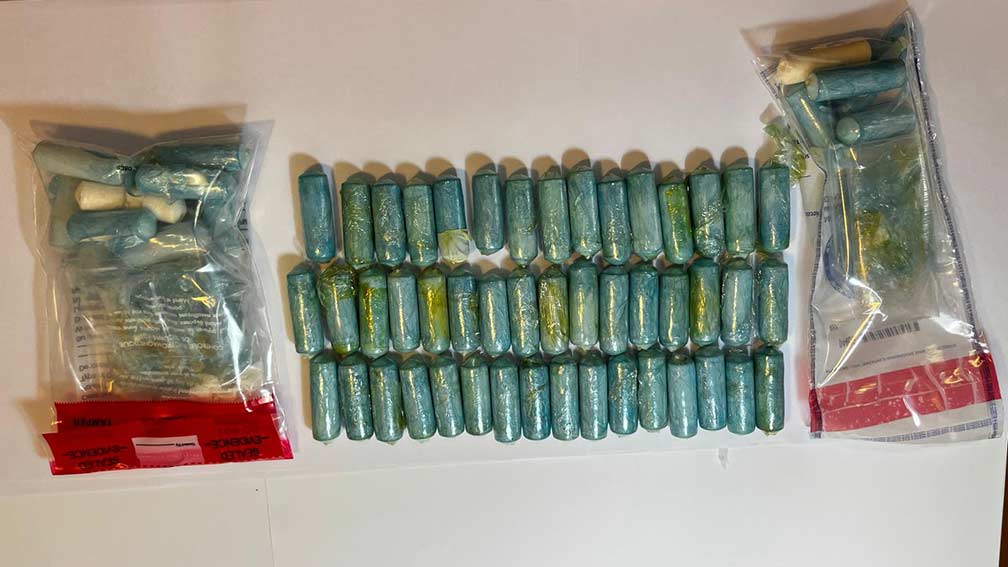 Da Barcellona ad Alghero con 64 ovuli di cocaina in pancia, arrestata una 73enne 1 Ovuli cocaina Alghero